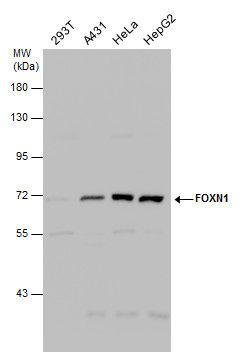 FOXN1 Rabbit Polyclonal Antibody