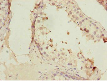 FOXN2 Antibody
