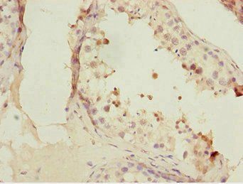 FOXN2 antibody