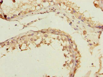 FOXN2 Antibody