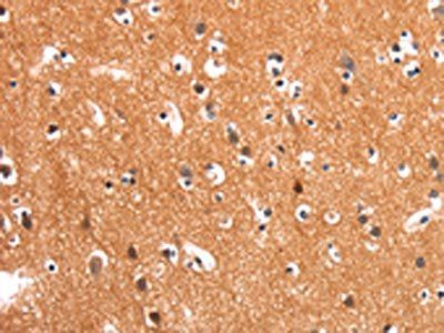 FOXN2 Antibody