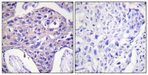FOXO1/3/4-pan (Ab-24/32) Antibody