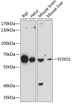 FOXO1 antibody