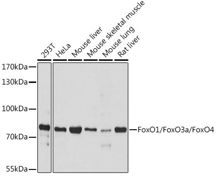 FoxO1 antibody