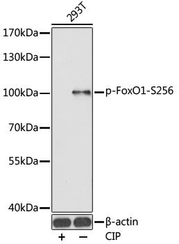 FOXO1 (Phospho-S256) antibody