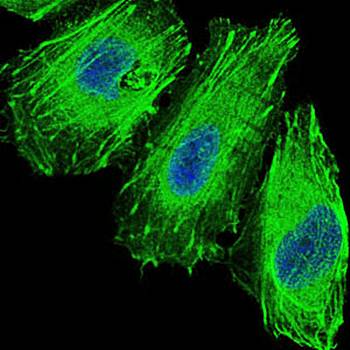 FOXO1 Antibody