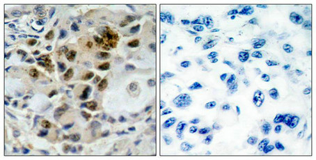 FOXO4 (Ab-197) Antibody