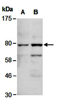 FOXP1 (C) Antibody, Rabbit Polyclonal