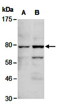 FOXP1 antibody