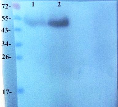 FOXP3 Rabbit Polyclonal Antibody
