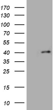 FOXR1 antibody