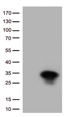 FOXR1 antibody