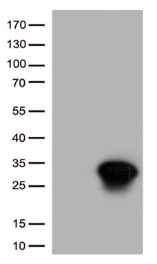 FOXR1 antibody