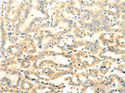 FOXR2 Antibody