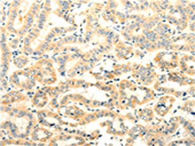 FOXR2 antibody