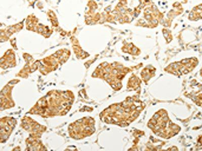 FOXR2 Antibody