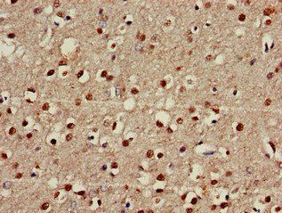 FOXRED2 Antibody