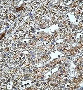 FOXRED2 Rabbit Polyclonal Antibody