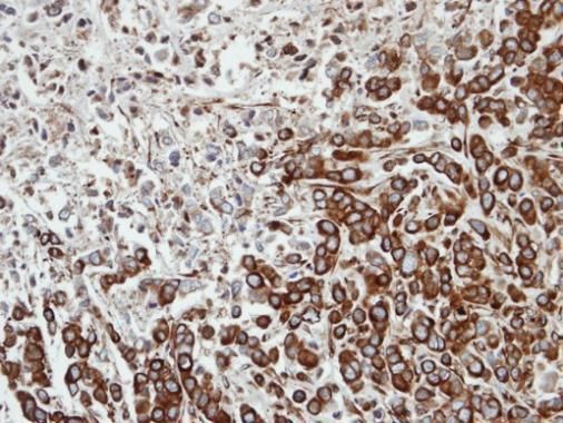 FPGT antibody [N2C2], Internal