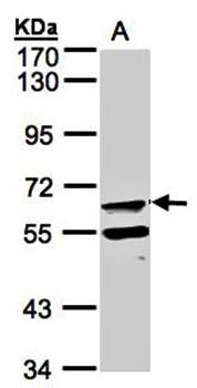 FPGT antibody