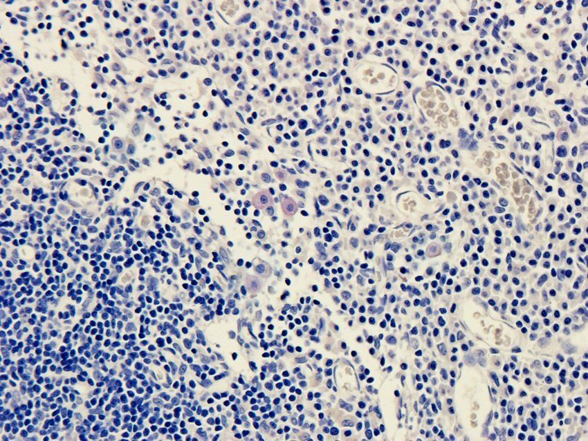 FPR1 Rabbit Polyclonal Antibody