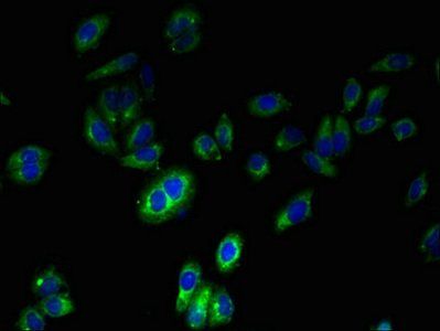 FPR2 antibody