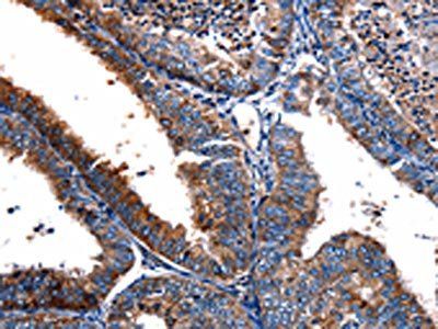 FPR2 Antibody