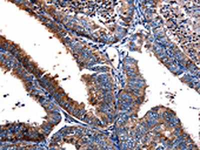 FPR2 antibody