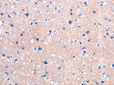 FPR2 Antibody