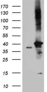 FRA2 (FOSL2) antibody