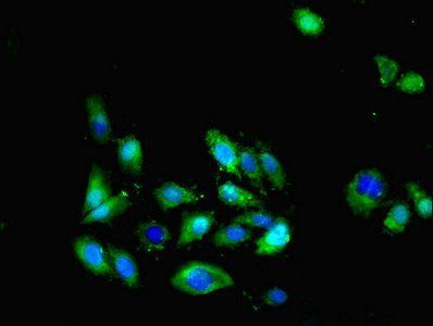 Fractalkine antibody