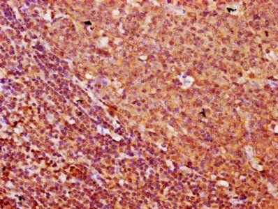 FREM1 Antibody