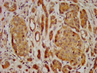 FREM2 Antibody