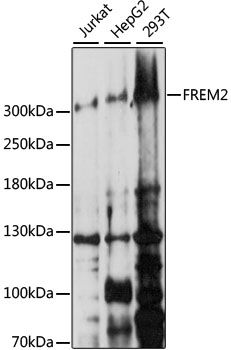 FREM2 antibody