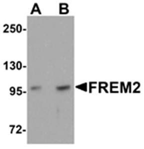 FREM2 Antibody