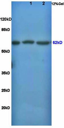 Frizzled 5 antibody