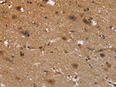 FRK Antibody