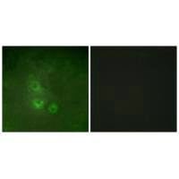 FRK Antibody