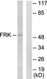 FRK Antibody