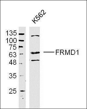FRMD1 Rabbit Polyclonal Antibody