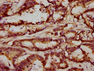 FRMD6 Antibody