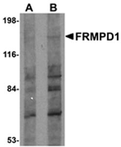 FRMPD1 Antibody