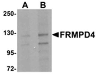 FRMPD4 Antibody