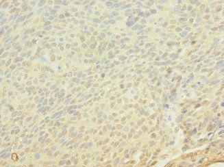 FRS3 Antibody