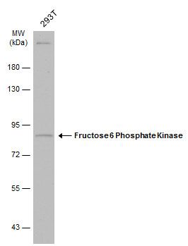 Fructose 6 Phosphate Kinase antibody