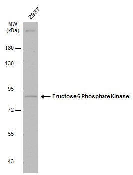 PFKM Rabbit Polyclonal Antibody