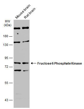 PFKM Rabbit Polyclonal Antibody