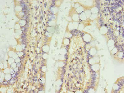 FSCB antibody