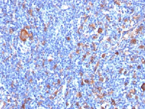 Fascin-1 (Reed-Sternberg Cell Marker) Antibody