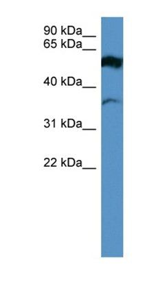 FSCN2 antibody